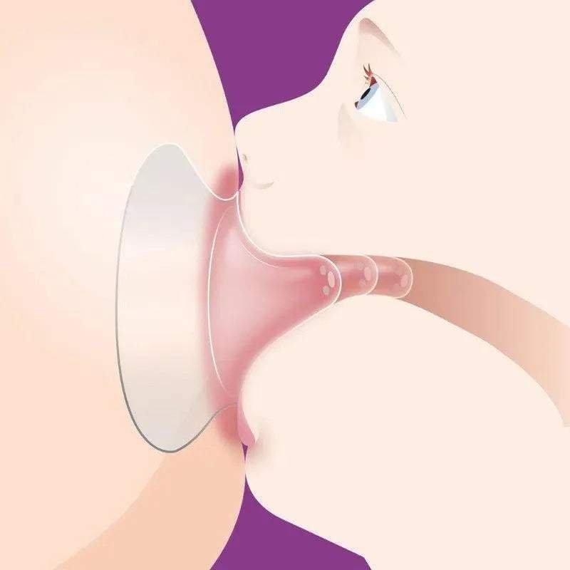 Avent Nipple Protector M Size